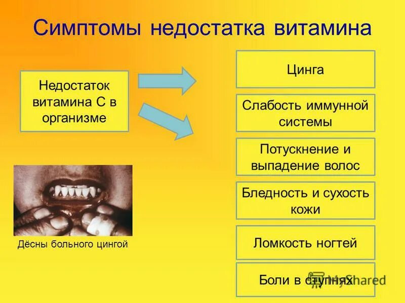 Какое заболевание при недостатке витамина с. Цинга (дефицит витамина с). цынг.