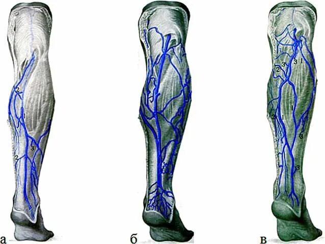 Икроножная вена. Латеральная подкожная Вена ноги. Латеральная Вена голени. Суральные вены анатомия.