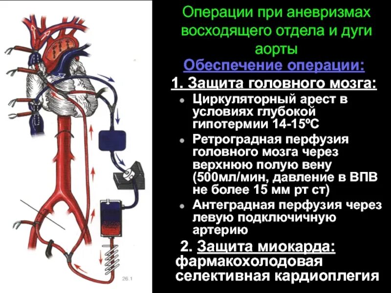 Хирургия аневризма восходящего отдела аорты. Операции при аневризмах. Операции при аневризмах сосудов. Классификация аневризм восходящего отдела аорты. Аневризма восходящей аорты операция