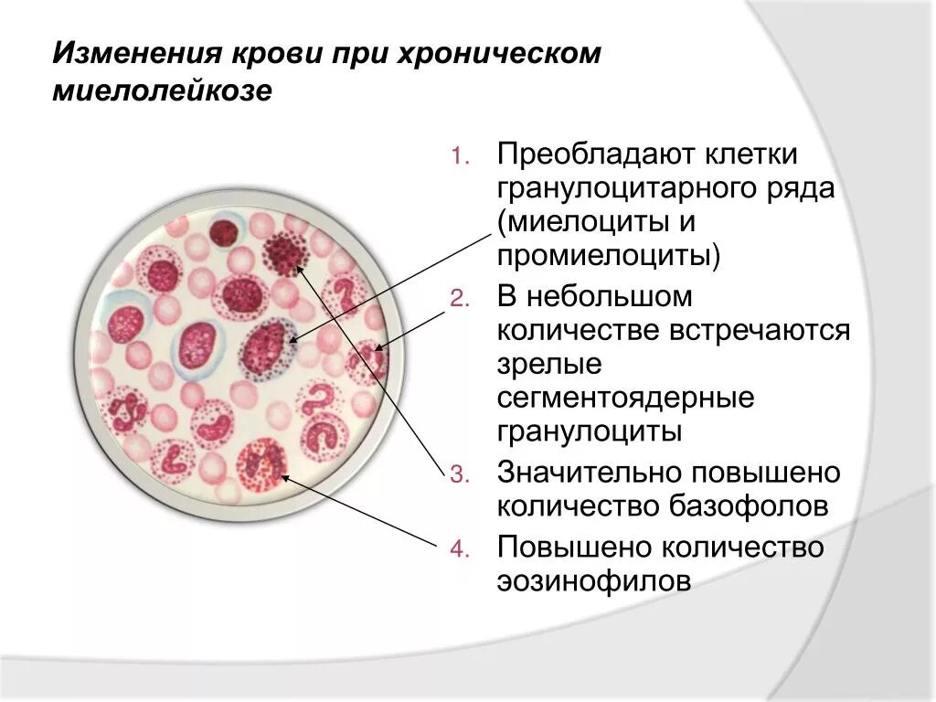 Метамиелоциты. Миелоциты, промонтциты. миелоциты гистология. миелоциты 1 в анализе крови что это такое. нейтрофилы метамиелоциты.