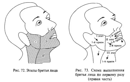 Бритье пациента алгоритм