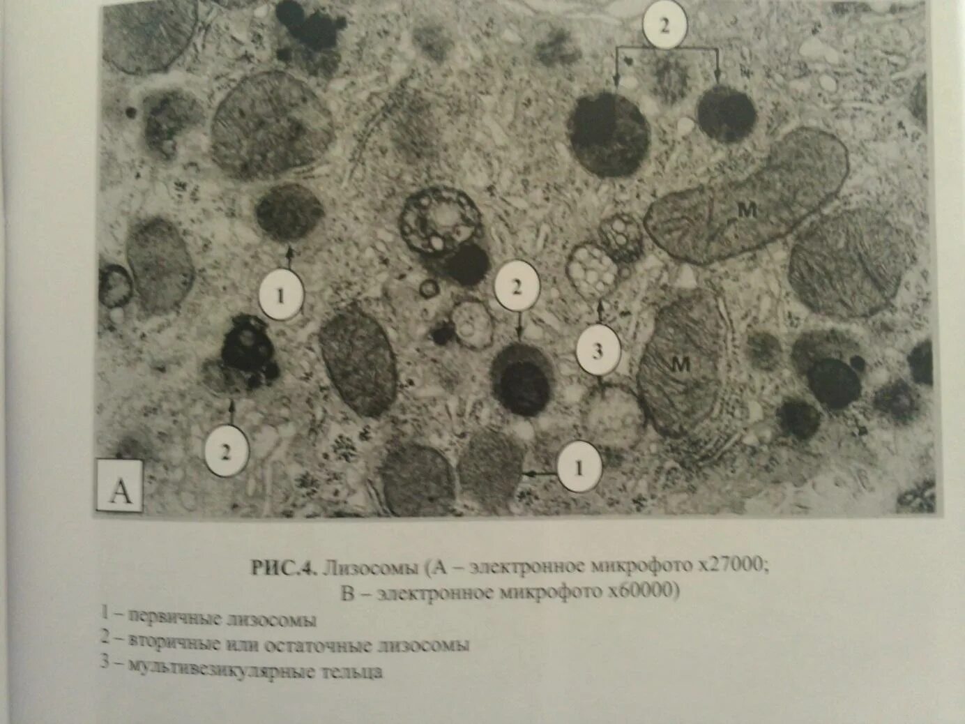 срез реснички микроскопия. центросома в клетке. опишите электронную микрофотографию. центросомы клеточный центр цитоскелет. лизосома электронная микрофотография.