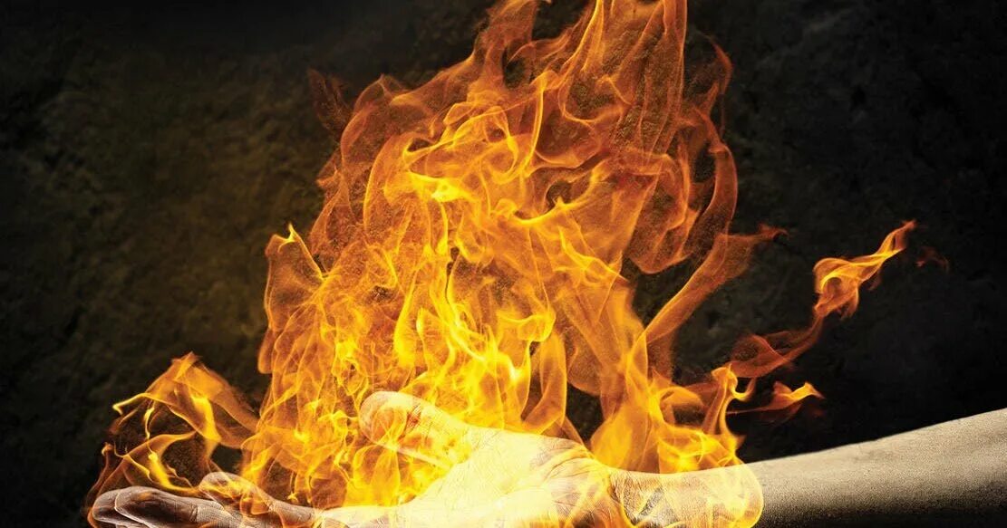 Термический ожог пламенем. Химический ожог 2 степени тяжести. При термическом ожоге при оказании первой помощи необходимо. Термический ожог пламенем. Факторы вызывающие термические ожоги.