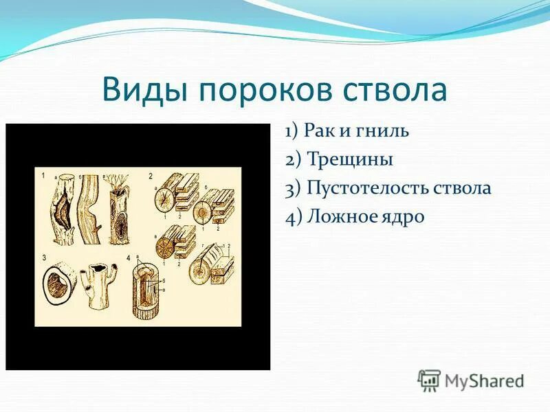какие виды пороков. врожденные аномалии развития плода классификация. класиификация приобретённых пороков сердца. классификация врожденных пороков развития по причине возникновения. пороки сердца стенозы клапанов недостаточность клапанов.