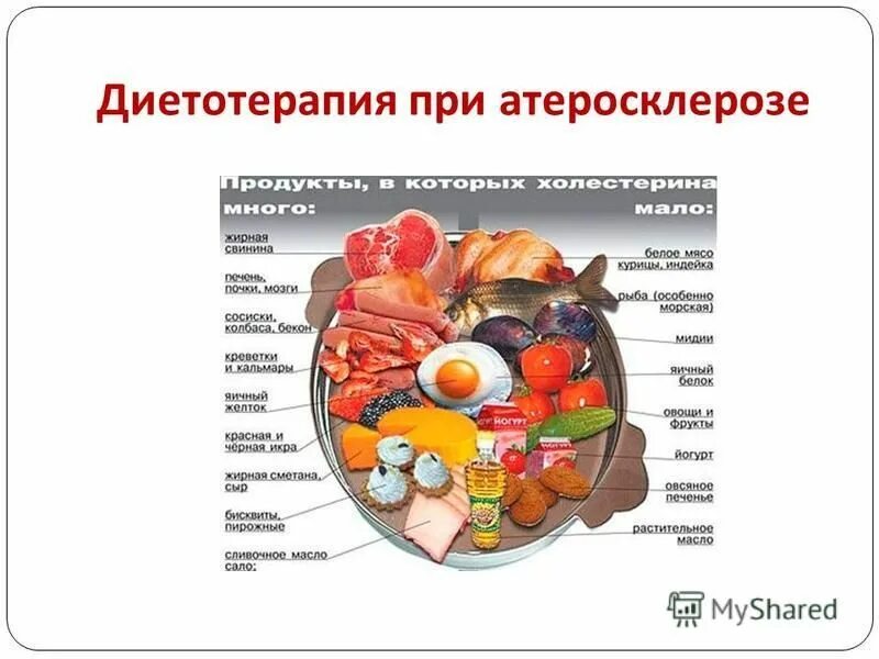 Продукты для мозга и сосудов. Атеросклероз принципы питания. Диета при остеосклерозе. Диетотерапия при атеросклерозе. Атеросклероз сосудов питание.