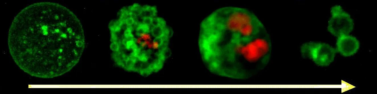 нормальная клетка и раковая. апоптоз раковых. апоптоз раковых. апоптоз опухолевых клеток. апоптоз при опухолях.