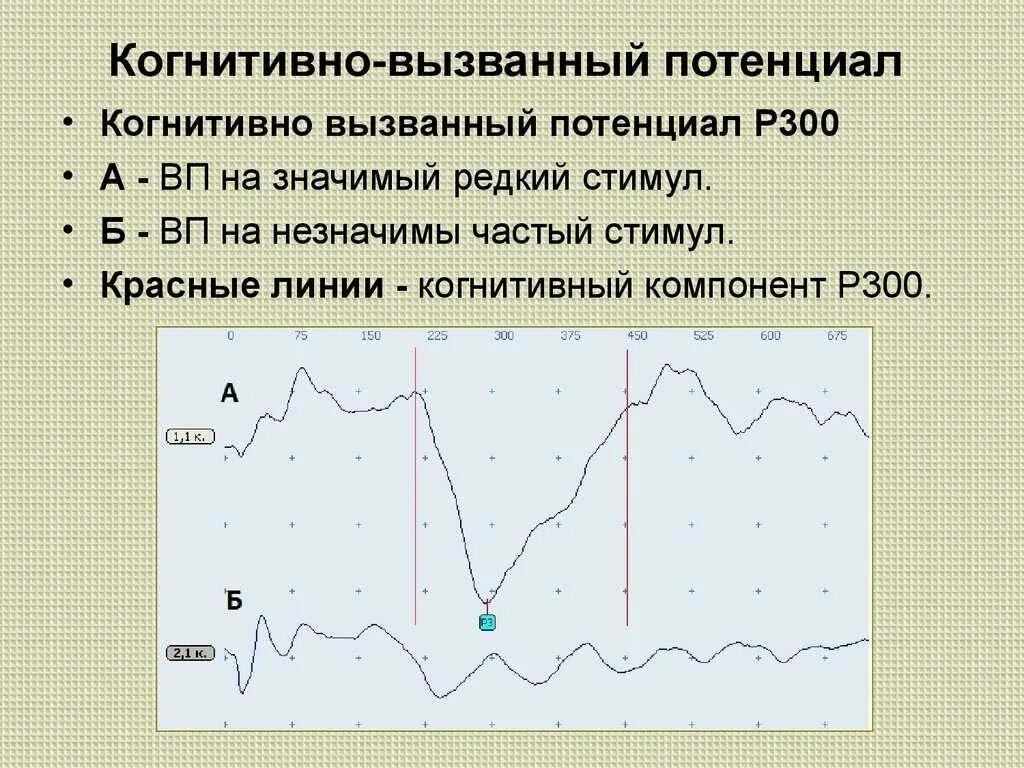 Потенциал ээг. Когнитивные вызванные потенциалы р300 методика. Когнитивные вызванные потенциалы ЭЭГ. Метод вызванных потенциалов (ВП). P300 когнитивно вызванные потенциалы.