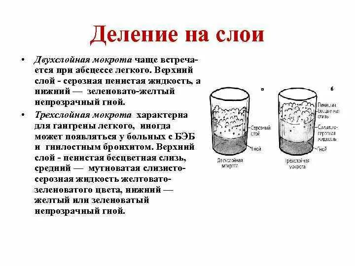 3 Слоя мокроты при абсцессе. Трехслойная мокрота характерна для. Трехслойная мокрота при абсцессе. Исследование мокроты при абсцессе.