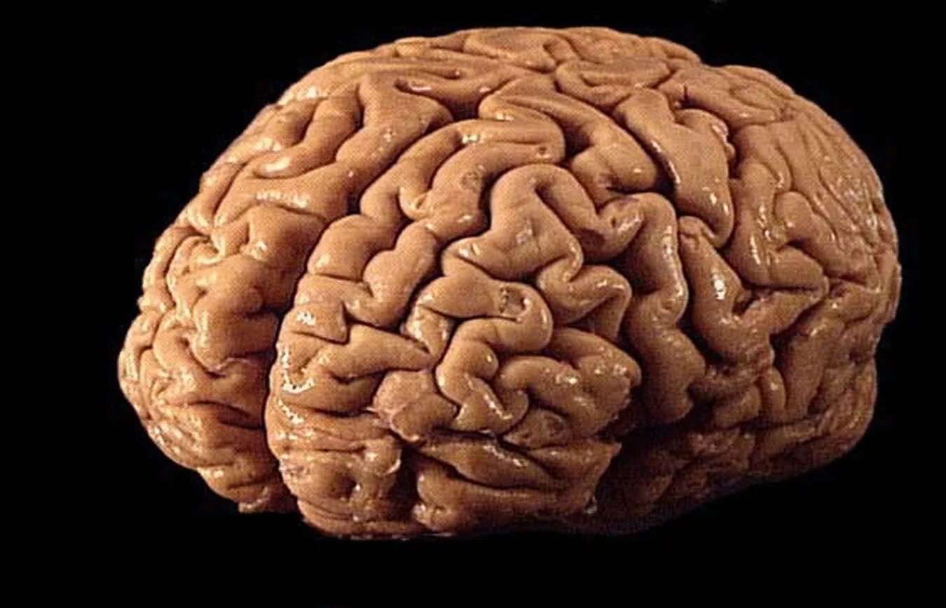 Едят ли мозг человека. Изображение мозга.