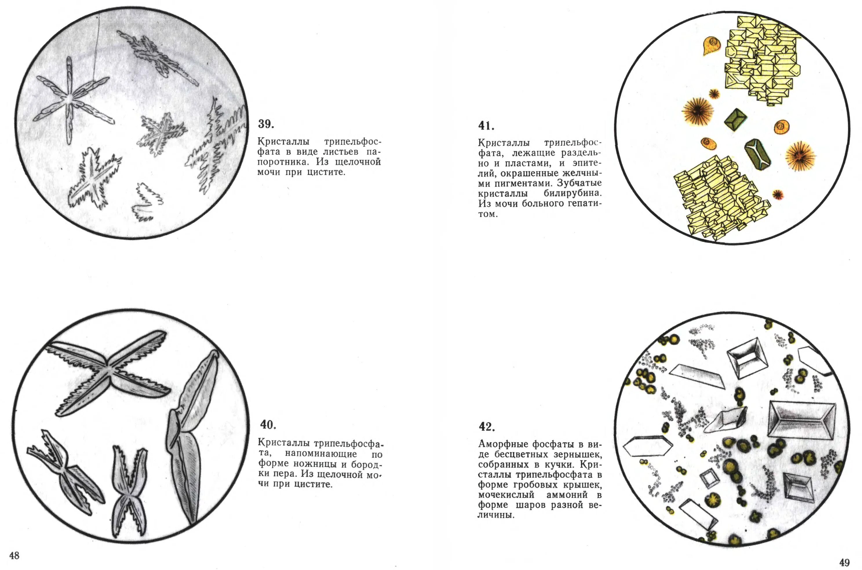 Микроскопия мочи трипельфосфаты. Атлас микроскопии осадков мочи Краевский в.я. Мочевой атлас микроскопия мочи. Микроскопия осадка мочи трипельфосфаты.
