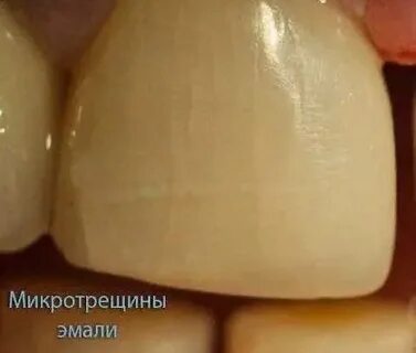 Что делать если образовались после
