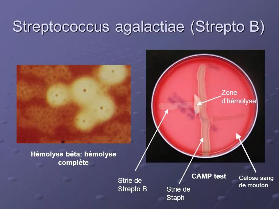 Агалактийный стрептококк. Стрептококкус агаре стрептококк на кровяном. Streptococcus agalactiae патогенез. Стрептококк pyogenes и agalactiae. Тест стрептококк группы а