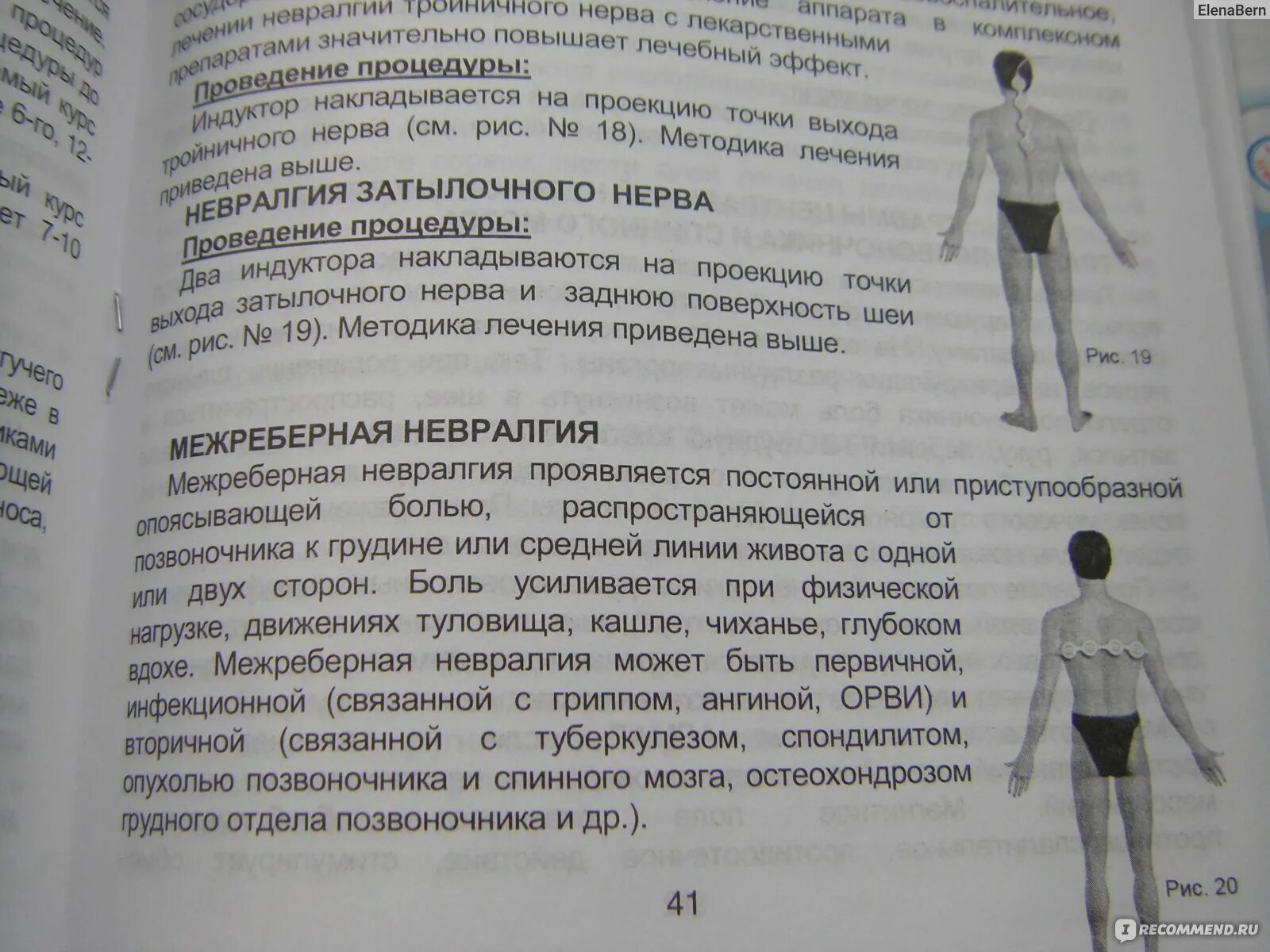 Как правильно накладывать алмаг. Алмаг как правильно накладывать. Алмаг-01 как пользоваться. Алмаг схемы наложения. Алмаг-01 при невралгии.