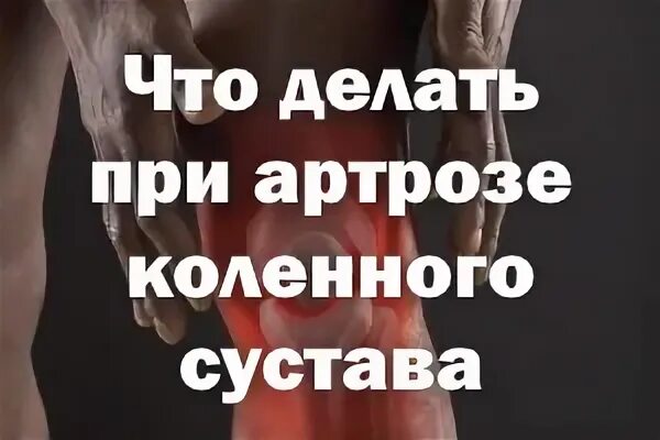 Что есть при артрозе коленного сустава