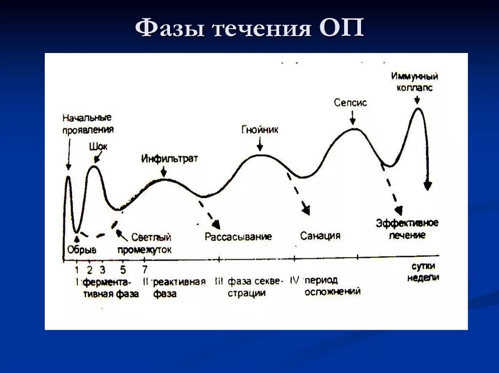 Фазы течения панкреатита. Фазы течения острого панкреатита. Фазовое течение острого панкреатита. )Фаза течения острого панкреатита 1а. Расширенная фаза