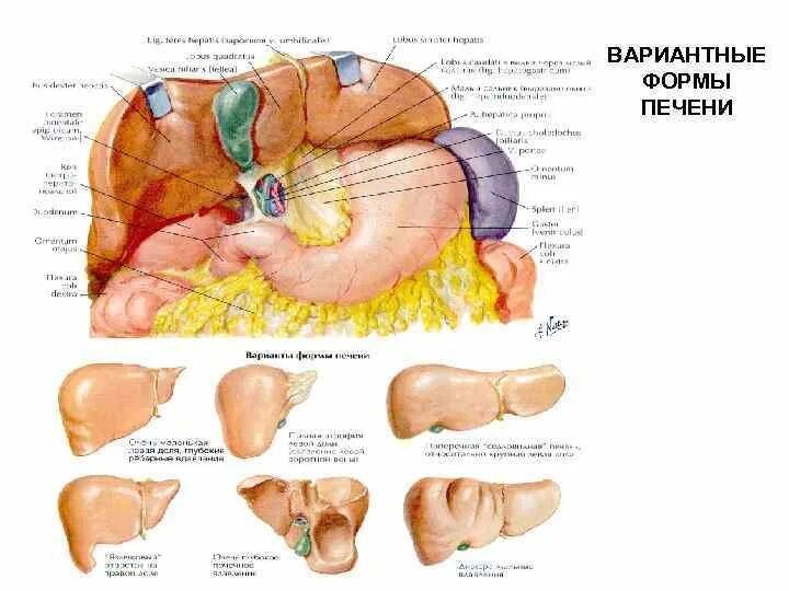 Печень какой формы. Вариантная анатомия печени. Анатомические варианты формы печени.