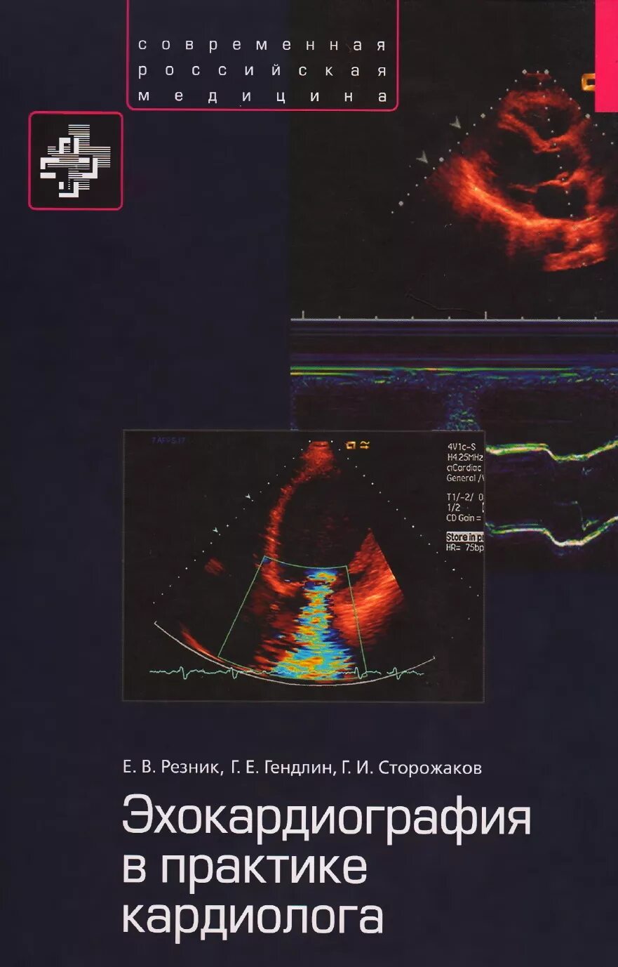 Электрокардиограмма пациента. Учеба в медицинском. Эхокардиография в практике кардиолога - резник е. Кардиология практика. Кардиология практика.