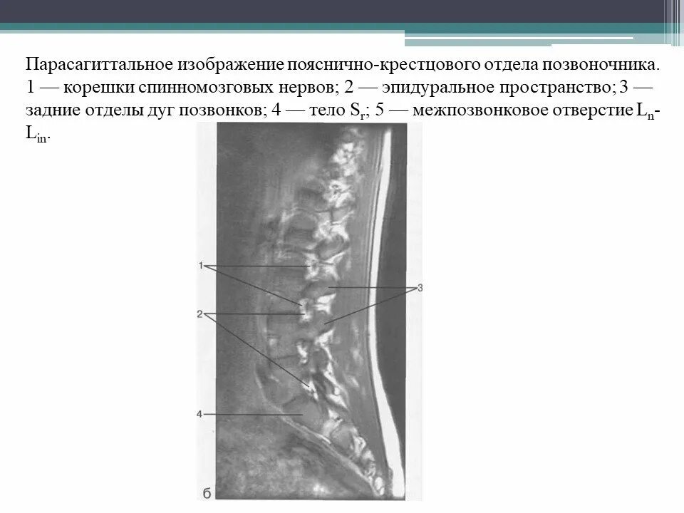 Рентген крестцового отдела позвоночника подготовка. Шейный отдел позвоночника рентген анатомия. Рентген поясничного отдела позвонка. Рентгеноанатомия позвонка. Функциональный рентген пояснично-крестцового.