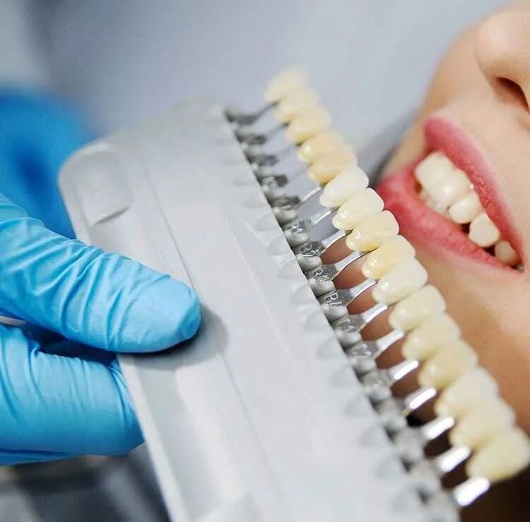 Со скольки лет отбеливают зубы. Тоны отбеливания зубов. Отбеливает ли йод зубы. Со скольки лет отбеливают зубы. 5д вайт отбеливающие полоски.