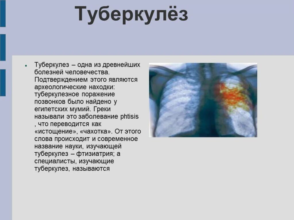 Как называли туберкулез. Туберкулез легких презентация. Туберкулез заболевание кратко. Презентация на тему туберкулез легких.