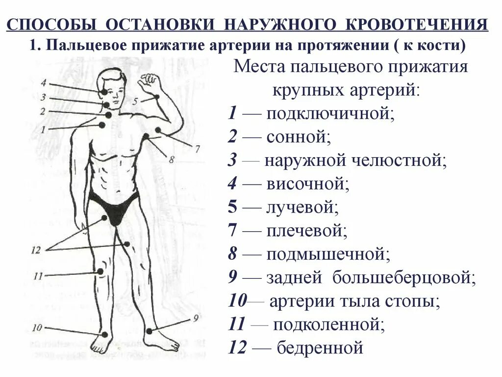 Способы остановки кровотечения пальцевое прижатие артерии. Места прижатия артерий при кровотечениях. Точки прижатия артерий при кровотечении. 12 Точек прижатия артерий при кровотечении. Точки пальцевого прижатия крупных артерий.