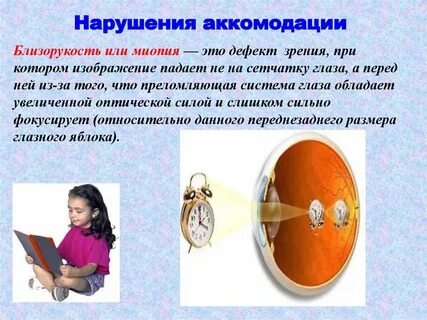 Патологическая миопия