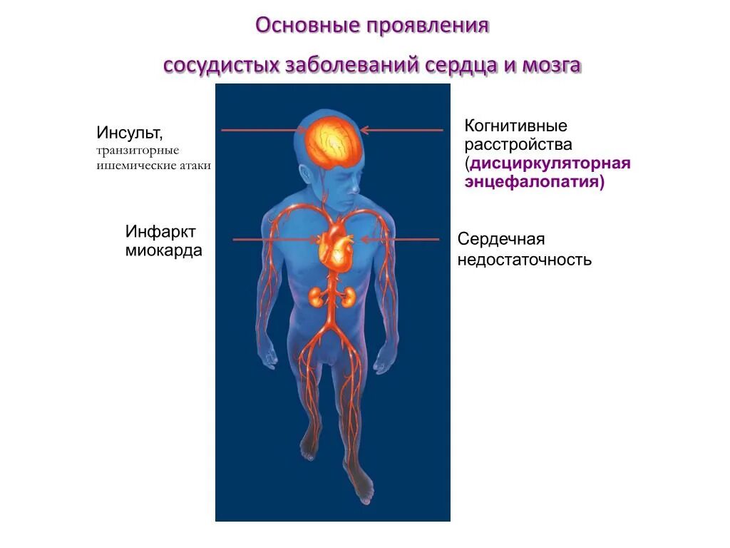 Заболевания нервной системы. Болезни сосудистой и нервной системы. Сосудистые заболевания нервной системы. Заболевания нервной системы кратко.