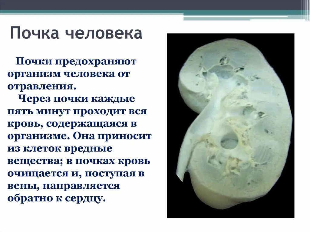 Почка анатомическое строение функции. Строение и функционирование почек. Если фото. Хроническая почечная недостаточность уремия. Почки для презентации.