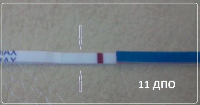 ДПО как выглядит. Грудь на 11 ДПО. Бугорки Монтгомери при беременности. 8 ДПО бишуртест.