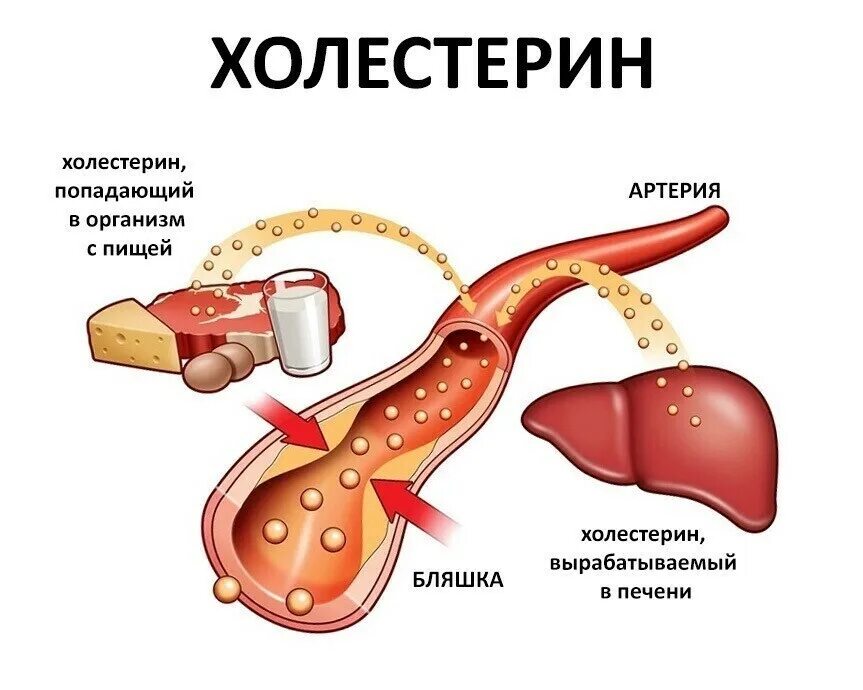 Холестерин что это. Повышение уровня холестерина в крови. xalesterin. повышенный уровень холестерина.