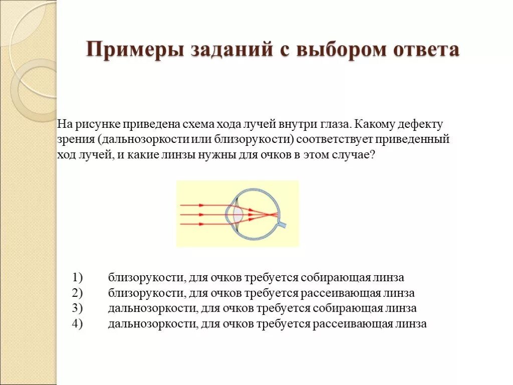 Ход лучей глаза человека. Близорукость ход лучей в глазе. Схема хода лучей внутри глаза. Близорукость схема хода лучей. Схема хода лучей при дальнозоркости.