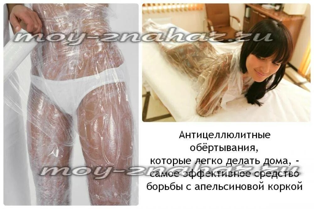 Горячее обертывание сколько раз в неделю. Обёртывание от целлюлита. горячее антицеллюлитное обертывание. целлюлит обертывание. обертывание ягодиц.