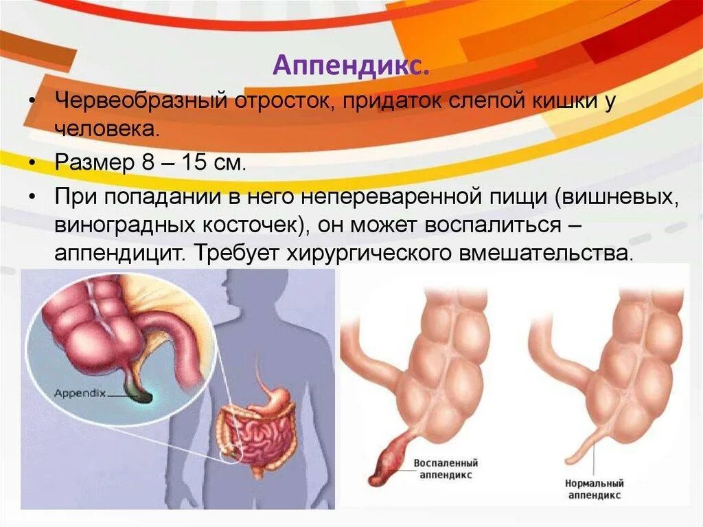 Аппендикс система органов. Слепая кишка и червеобразный отросток. Факторы воспаления аппендикса. Червеобразный отросток функции в организме человека. Функции отростка аппендикса.