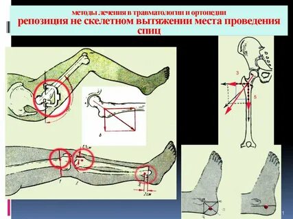 Как попасть в травматологию