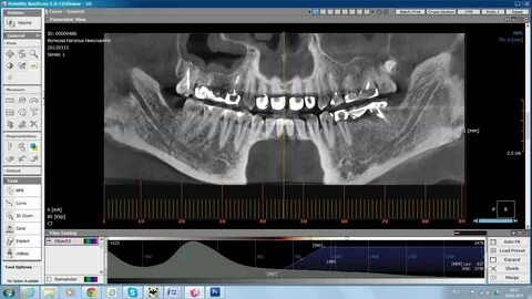 Point 3d