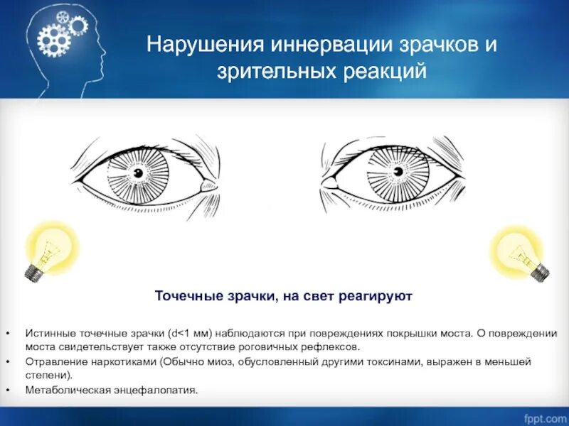 Проверка реакции зрачков. Нарушение реакции зрачков на свет. точечные зрачки наблюдаются при отравлении. выявление реакции зрачка на свет.