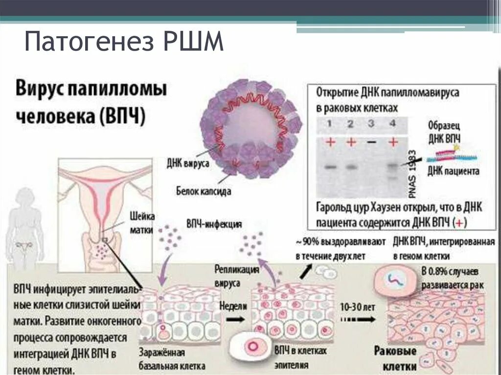 Патогенез папилломавирусной инфекции. Вирус папилломы строение. Папилломавирусная инфекция факторы. Если есть рак шейки матки