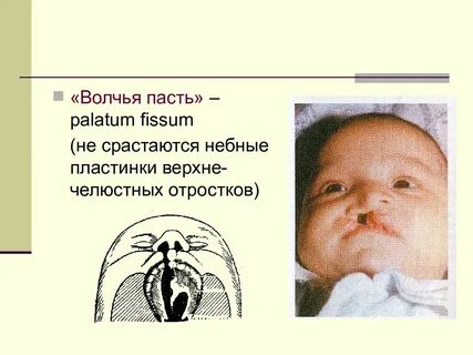 Пастью морфологический