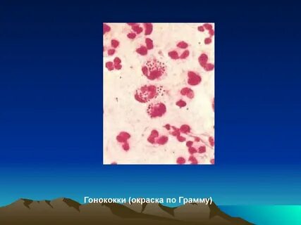 Гонококки стрептококки