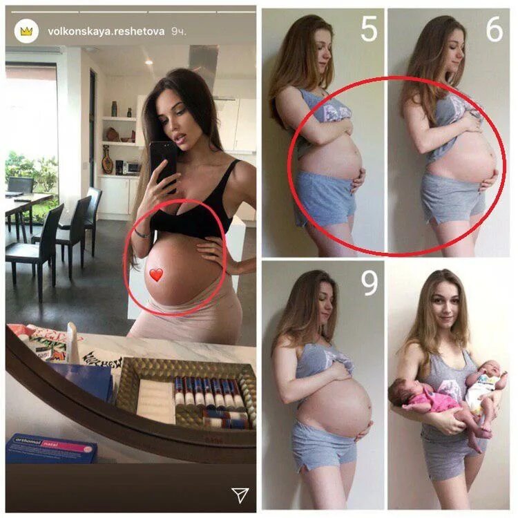 Животики беременных двойней. Живот у беременных по месяцам двойня. Живот с двойней по неделям. Какой живот при двойне. Живот с двойней по неделям.