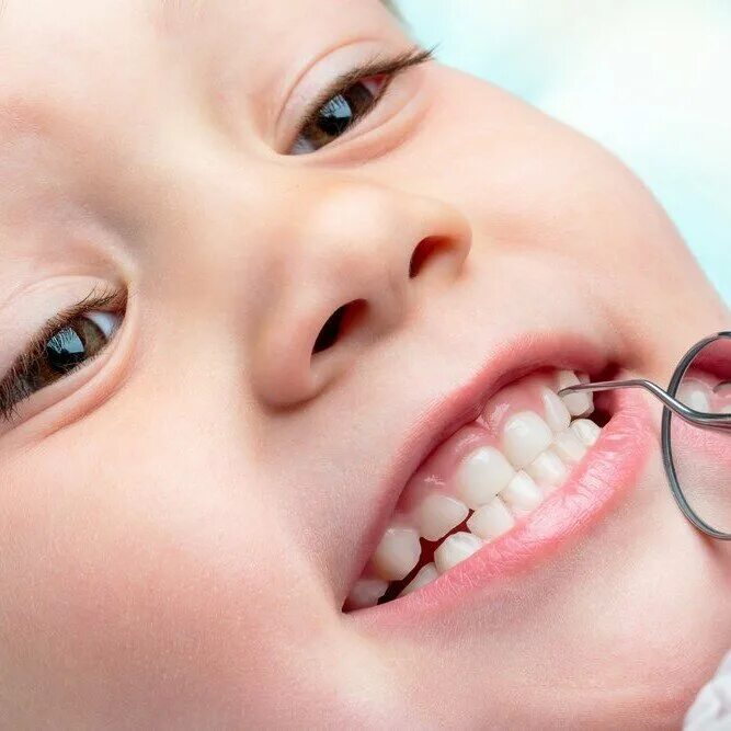 Пломбы детям на молочные зубы. Пломбы детям на молочные зубы. Пломбы детям на молочные зубы. Цветные пломбы детские. Пломбы детям на молочные зубы.