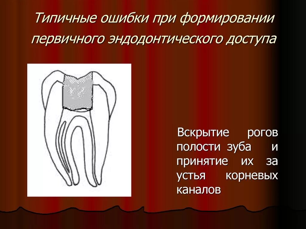 Формирование эндодонтического доступа. Этапы раскрытия полости зуба. Перфорация стенки полости зуба. Вскрытие полости зуба эндодонтия. Осложнения эндодонтического лечения