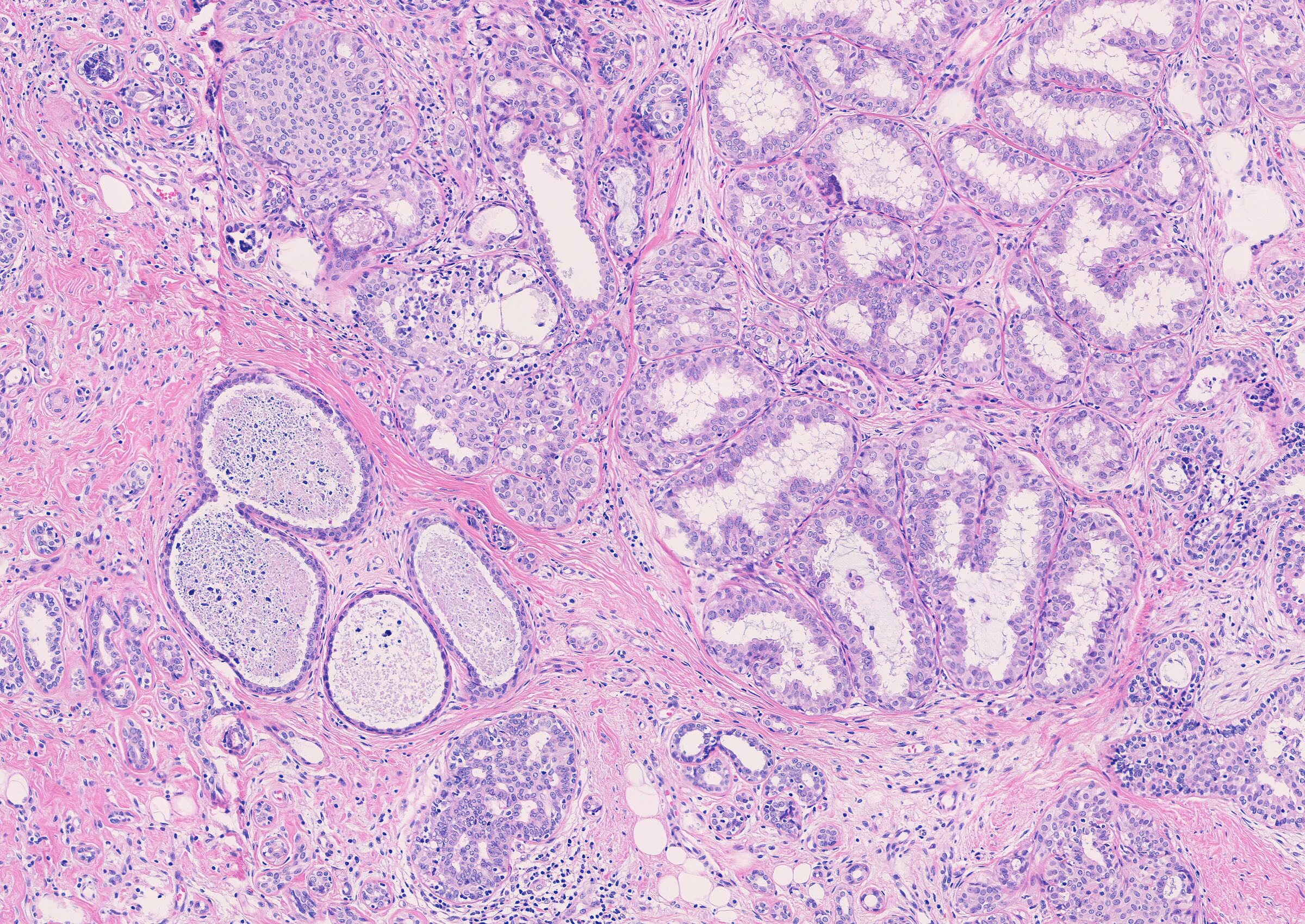 Поперечный срез зародыша курицы. Мезенхима зародыша курицы гистология. Мезенхима препарат гистология. Трёхдневный зародыш курицы гистология. Мезенхима зародыша цыпленка гистология.