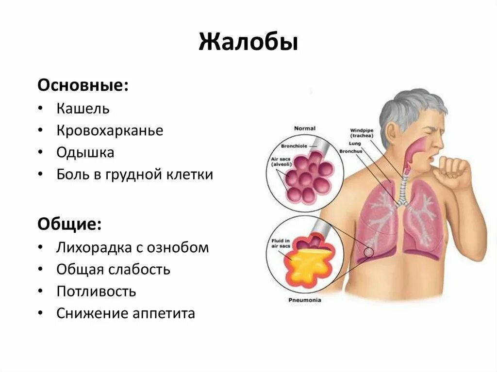 Выделение мокроты без кашля. При кашле с мокрокротой. Кашель с мокротой заболевания.