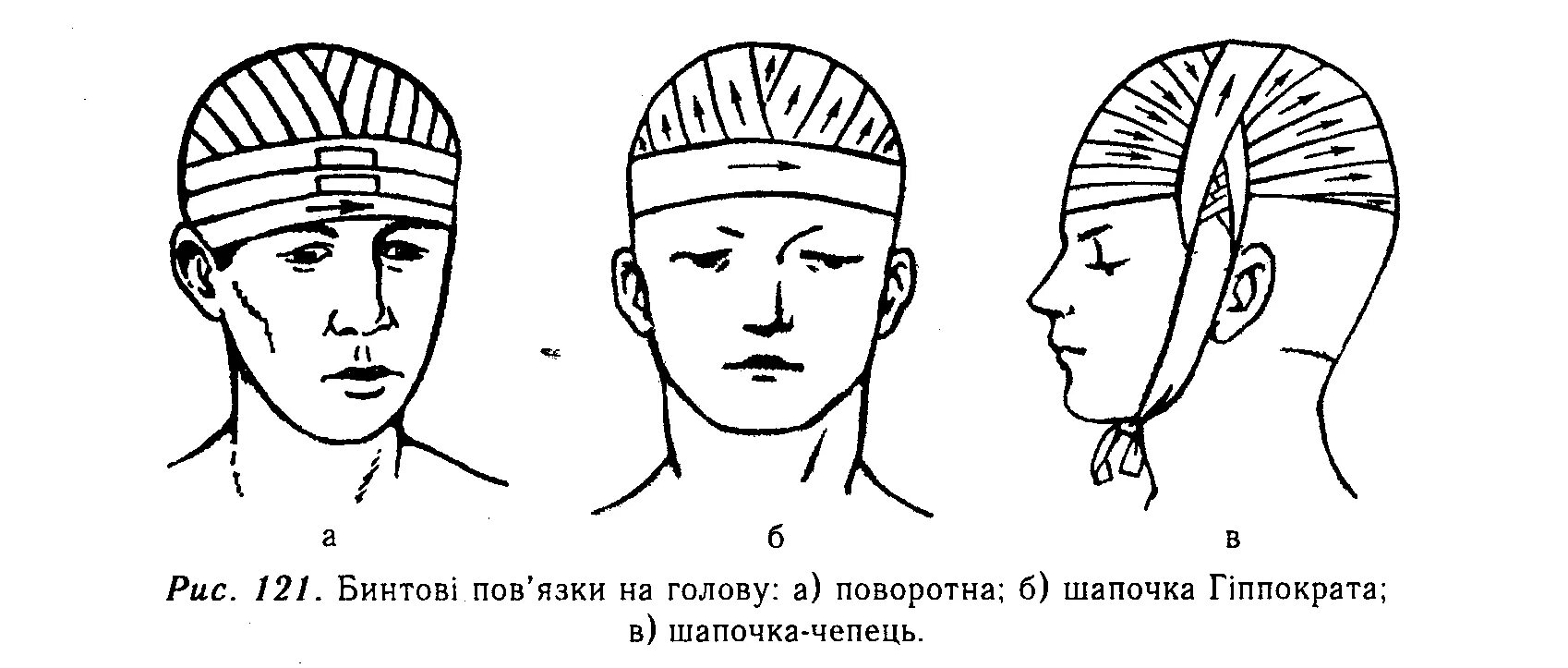 Повязка шапочка гиппократа техника наложения. Чепец и шапочка Гиппократа. Чепец Гиппократа повязка. Перевязка шапочка Гиппократа. Бинтование головы шапочка.