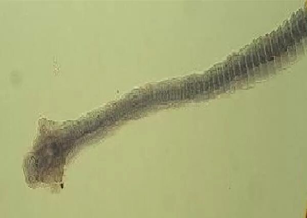 Карликовый цепень (hymenolepis nana). Гименолепидоз хеликс. Энтеробиоз и гименолепидоз. Гименолепидоз хеликс. Гименолепидоз хеликс.