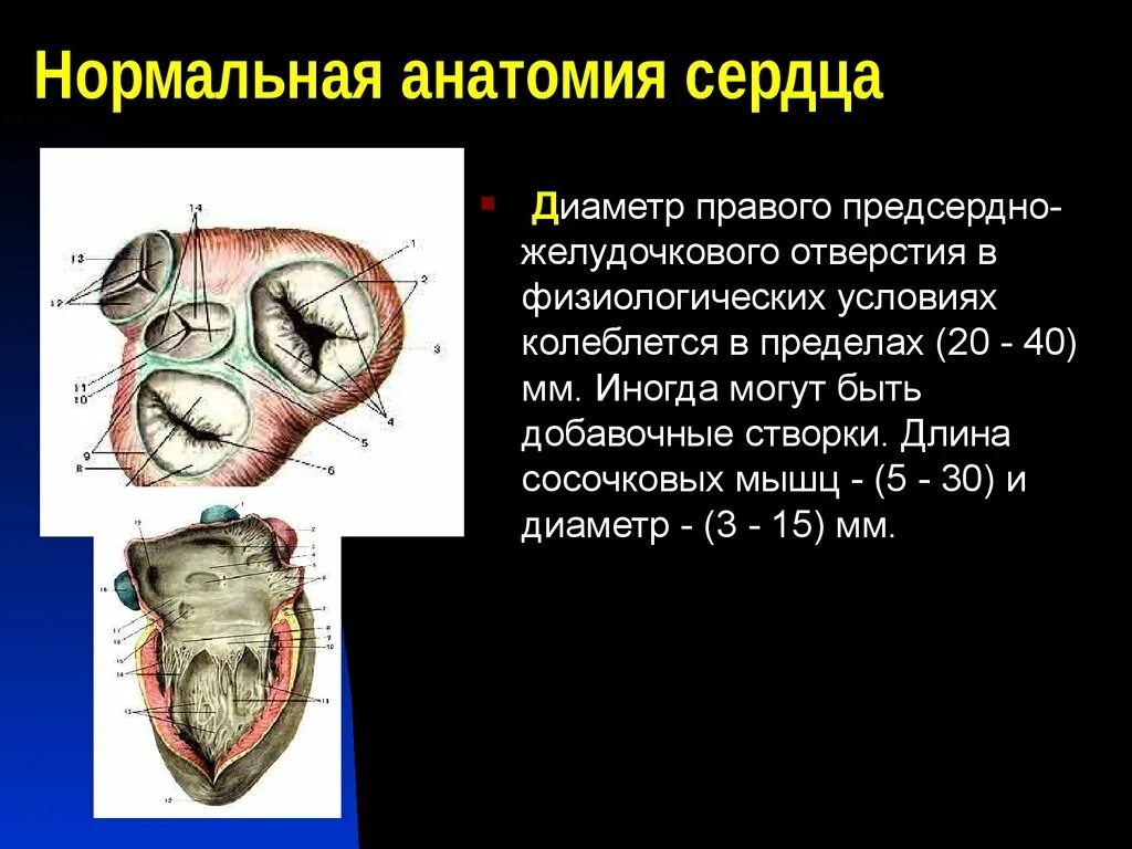 Нормальная анатомия сердца. Предсердно желудочковые отверстия сердца. Предсердно желудочковое отверстие анатомия. Левое предсердно-желудочковое отверстие. Клапан правого предсердно желудочкового отверстия