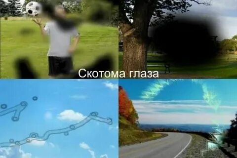 Рябит в глазах причины