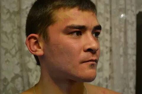Багровое лицо