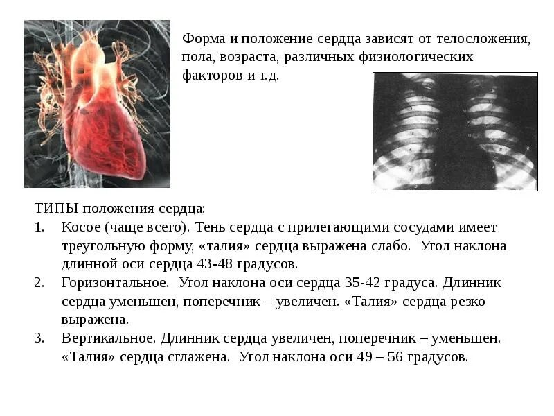 Ситуация сердца. Варианты положения сердца. праворасположенное правосформированное сердце. положение сердца зависит.